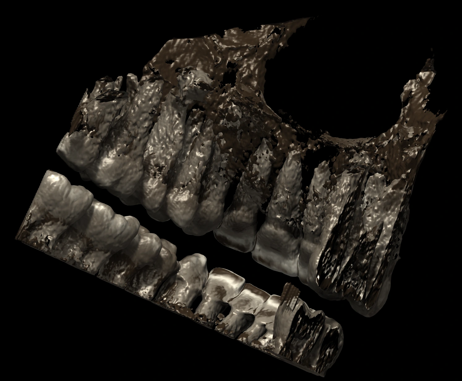 A 3D surface reconstruction of a dental cone-beam CT: the
                    upper and lower tooth arches lit from one side against
                    black, with individual roots, contact shadow between the
                    teeth and a specular highlight on the enamel.